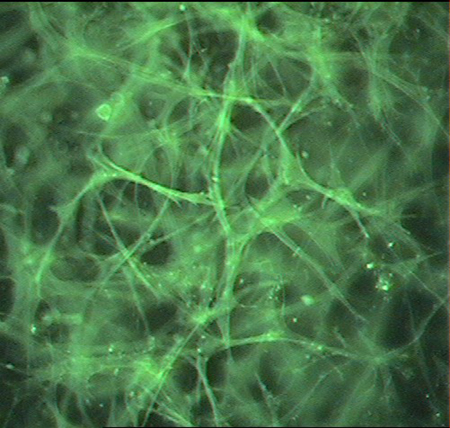 This figure shows skeletal muscle microvascular endothelial cells cultured in a three-dimensional collagen matrix. The cells elongate and form network connections with other endothelial cells in the matrix. 